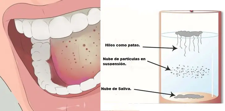 Prueba casera para detectar la Cándida