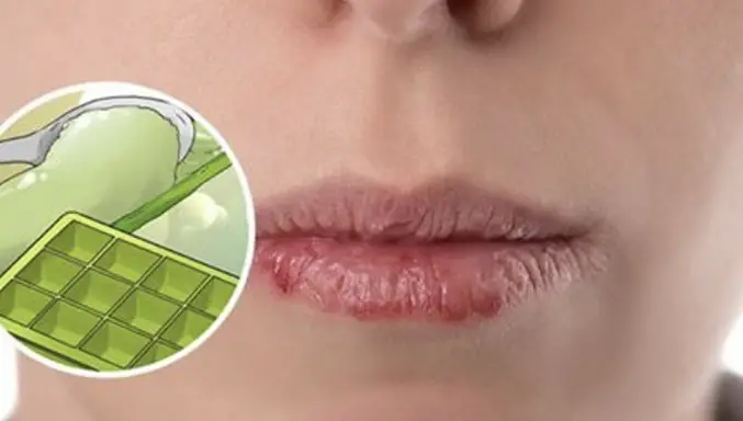 Remedio Natural Para Labios Secos