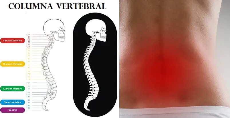 C Mo Aliviar El Dolor En La Espalda Baja O Lumbar