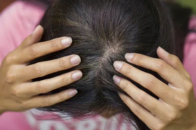 Cómo terminar con las canas de manera natural