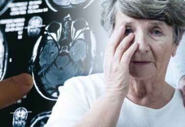 Síntomas de demencia que aparecen hasta 10 años antes