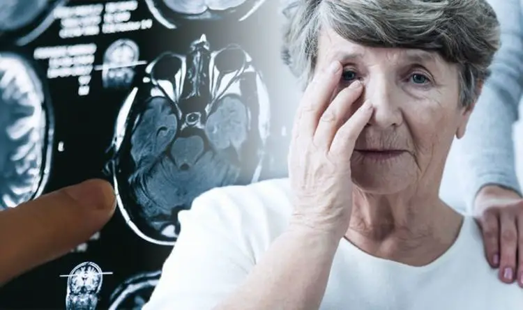 Síntomas de demencia que aparecen hasta 10 años antes